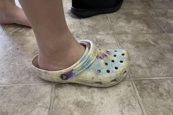 Cons Of Loose Crocs